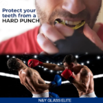 Mouth Guard